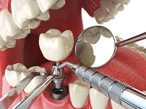Best Knocked-Out Tooth Emergency  in Tillamook, OR